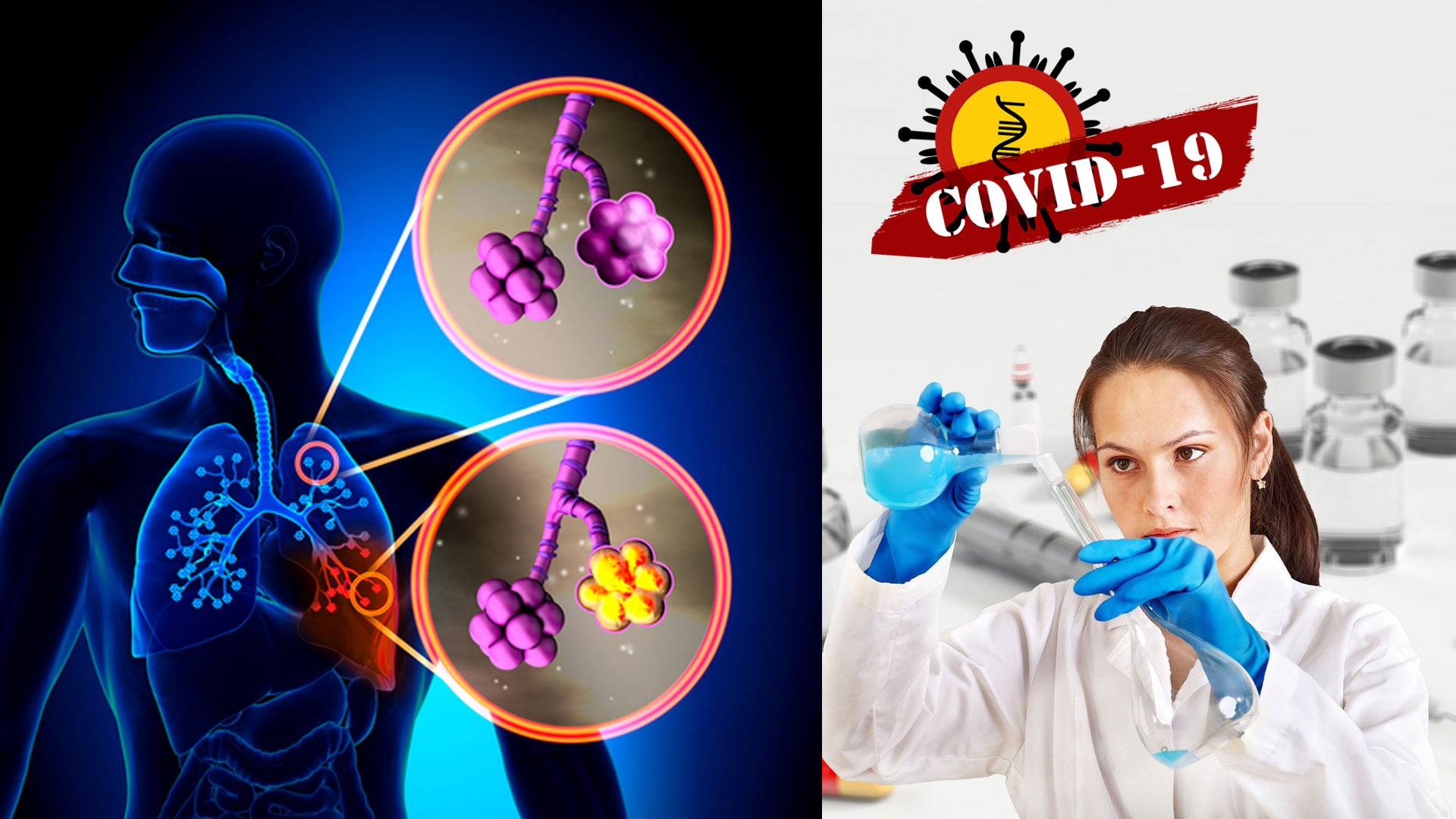 Sperimentazione vaccino covid-19