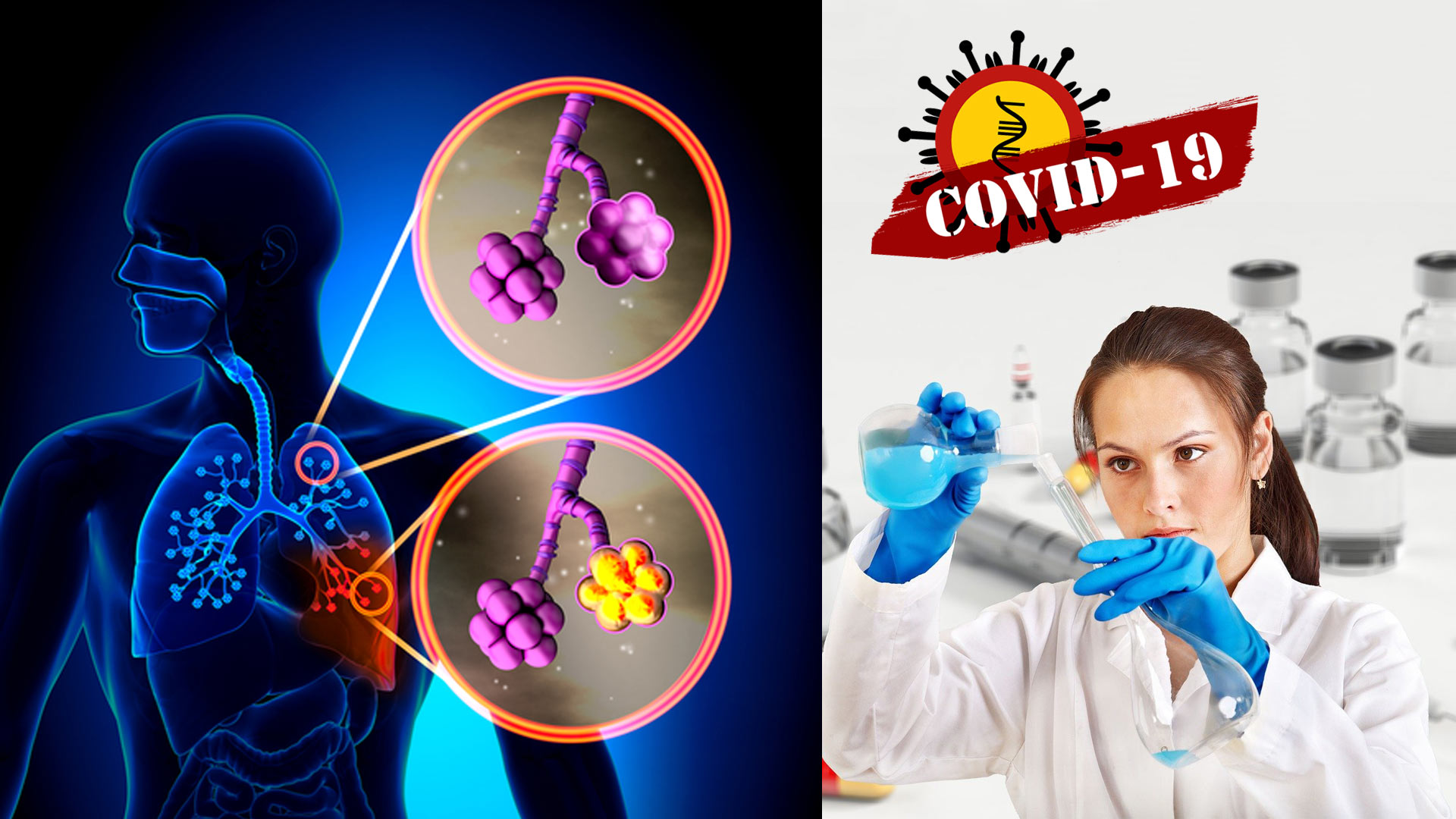 Covid-19, vaccino anglo-italiano in studio a Oxford, forse 100 milioni di dosi a dicembre
