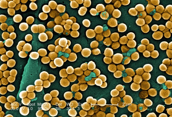 Staffilococcus aureus